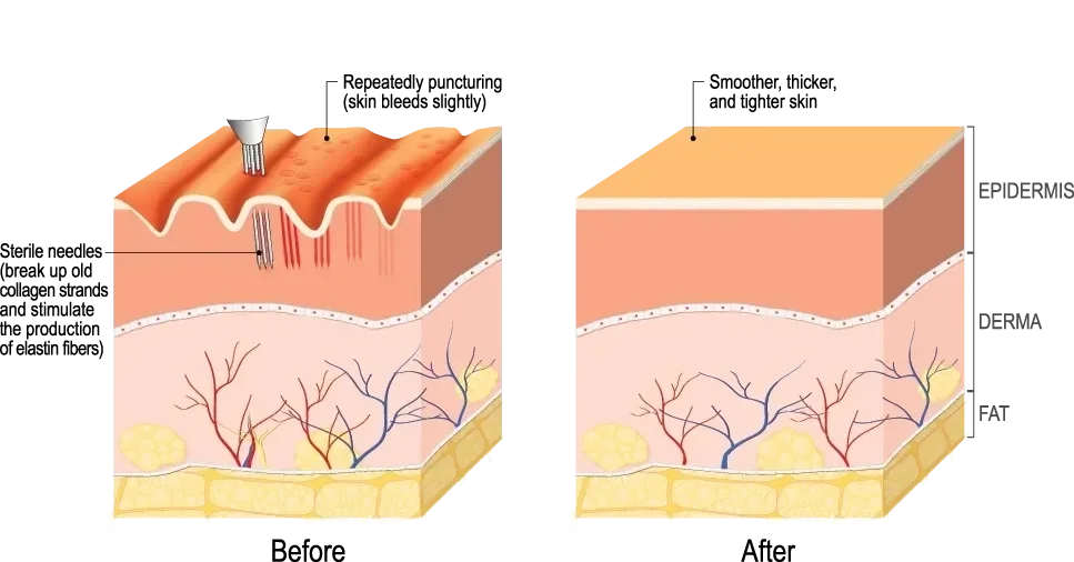 skin tone and texture